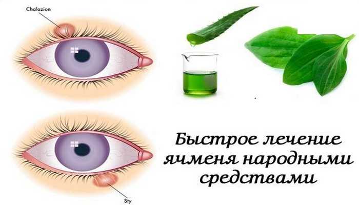 Очень помогают и примочки с травяными настоями.