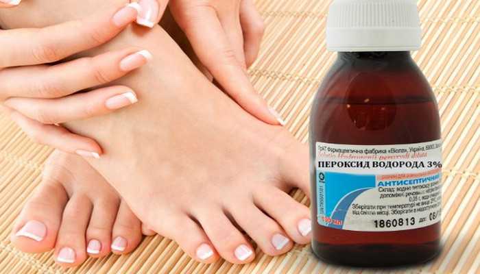 Лечение грибка на ногтях ног перекисью водорода возможно благодаря её свойству размягчать и отделять от здоровых тканей